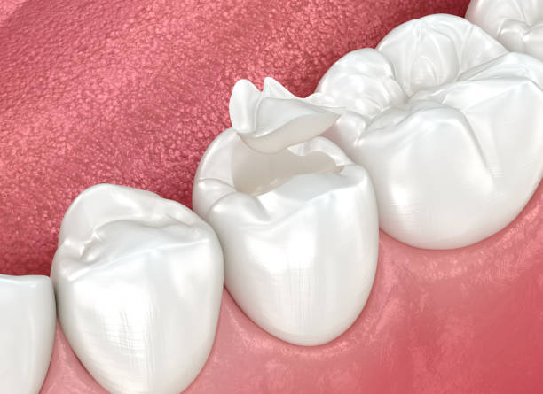 Best Tooth Extraction  in Yankton, SD